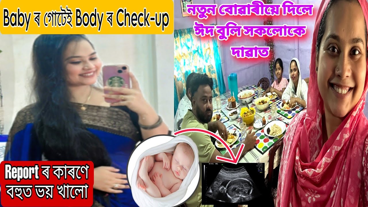 Baby ৰ Report দেখি ভয় খাই গলো😓 Pregnancy ত এইটো Scan বহুত important / আজি ঘৰত আলহিয়ে আলহি ঈদ বুলি😍
