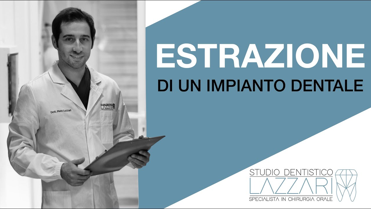 Quando si deve rimuovere un impianto dentale?