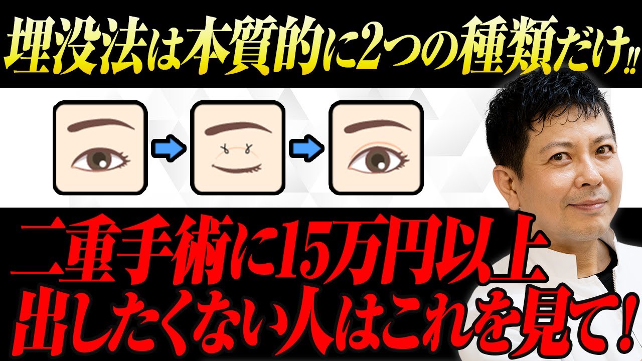 【何故値段が変わる？】高い埋没法と安い埋没法 何が違うの？みんなの質問解決【二重埋没】