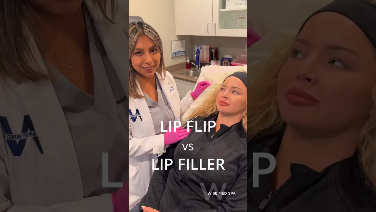 Lip Flip vs Lip Filler at Wise Med Spa in Wayne, NJ! 