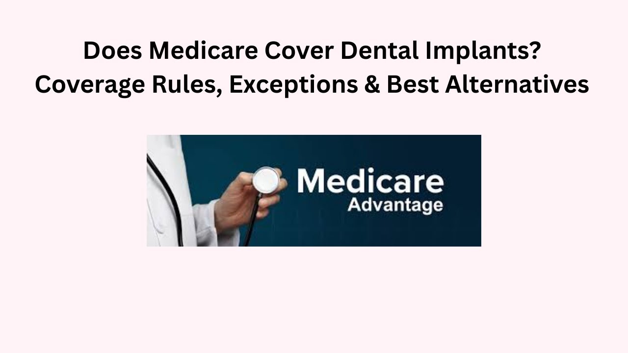 Does Medicare Cover Dental Implants? Coverage Rules, Exceptions & Best Alternatives