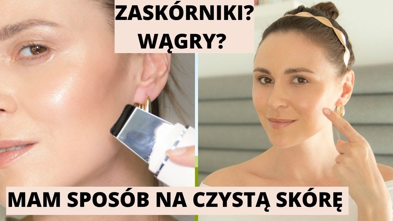 ZASKÓRNIKI? WĄGRY? ZNALAZŁAM SPOSÓB❤️ WIECZORNA RUTYNA PIELĘGNACYJNA ❤️ PEELING KAWITACYJNY