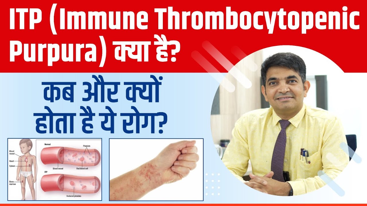 ITP Symptoms & Causes in Children | बच्चो ITP के कारण और लक्षण | Dr Atish Bakane
