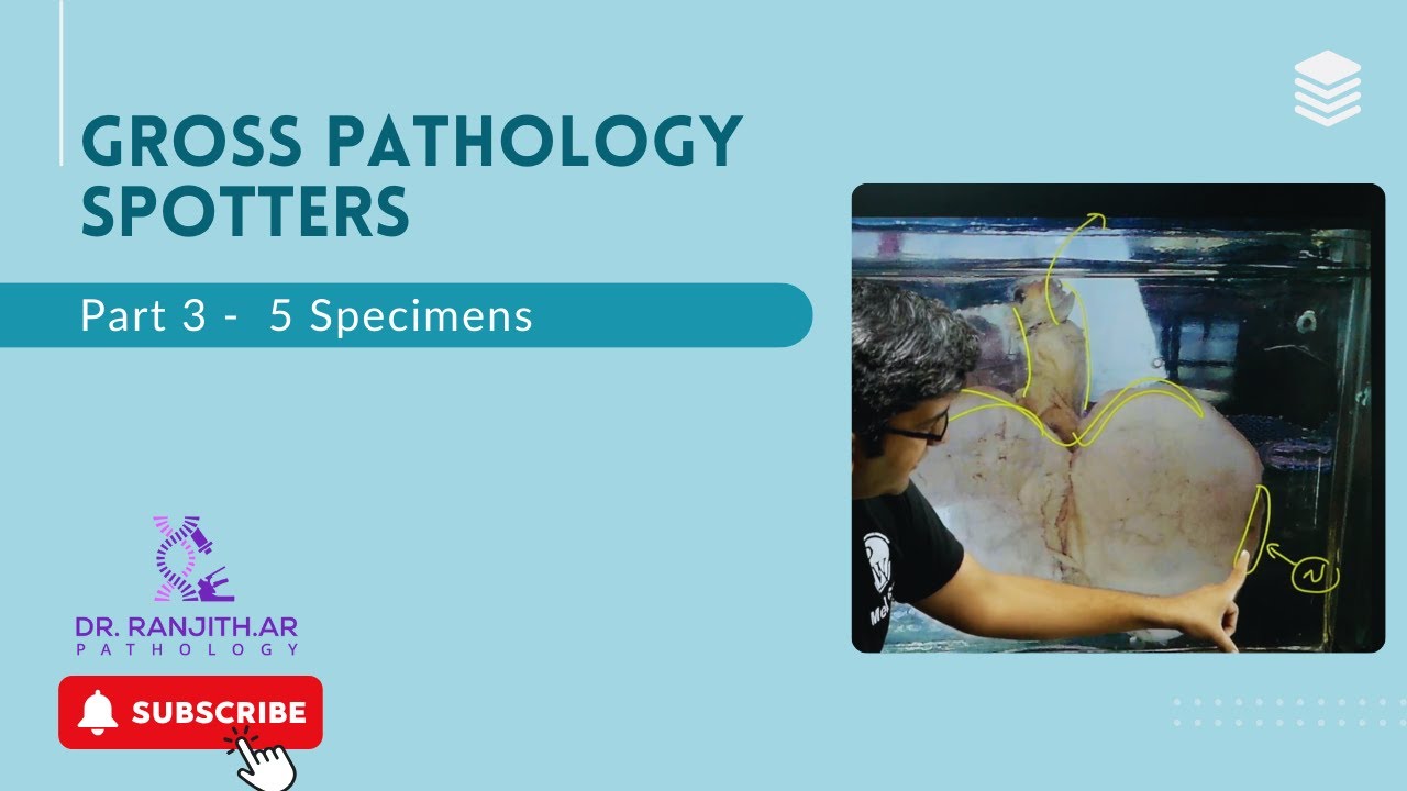 Gross Spotters Part 3 for 2nd MBBS Practicals