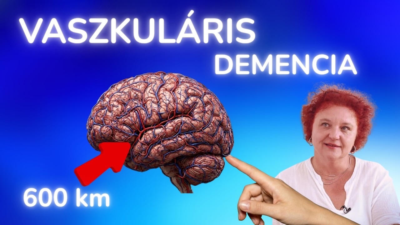 Vaszkuláris demencia (nagy érzelmi kilengések) Vascular Dementia (in Hungarian)