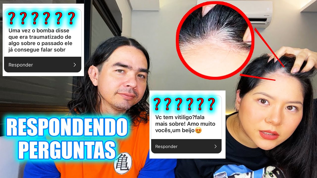 TENHO VITILIGO - RESPONDENDO PERGUNTAS | Canal Maromba