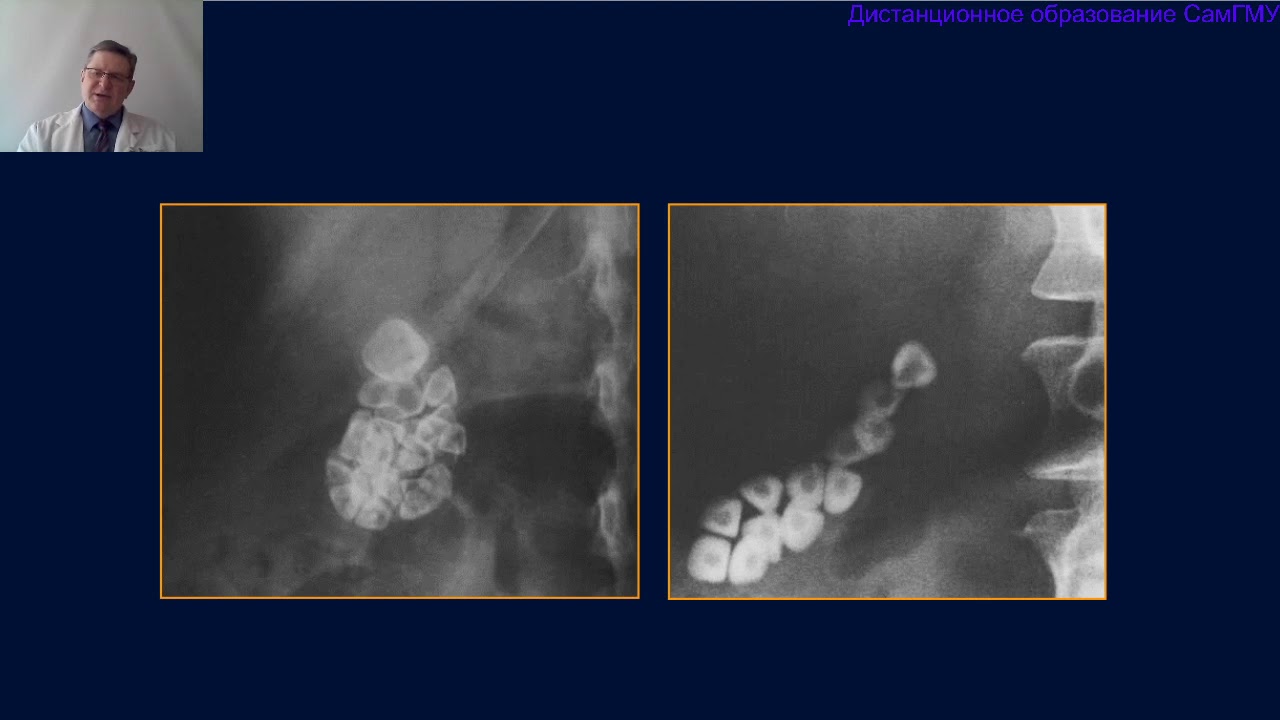 Лучевая диагностика заболеваний печени и гепатобилиарной системы  Часть 1  Лектор Капишников А В