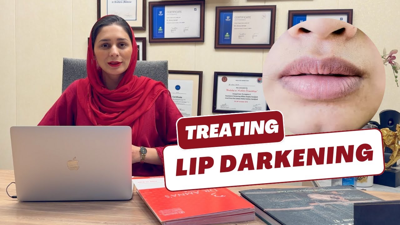 Lip Darkening: Causes, Prevention, and Treatments