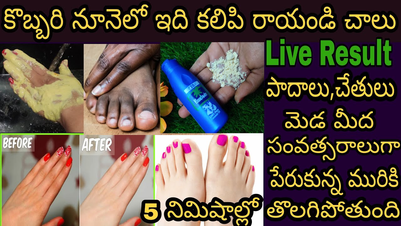 🔥చేతులు, పాదాలు, మెడ మీద సంవత్సరాలుగా పేరుకున్న మురికి 5 నిమిషాల్లో తొలిగిపోతుంది 🧞 | Remove Sun-Tan
