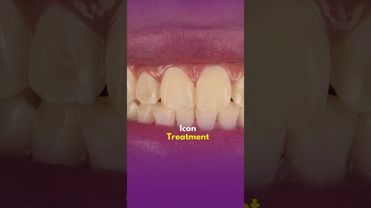 Icon treatment : Before & after icon treatment 😍 