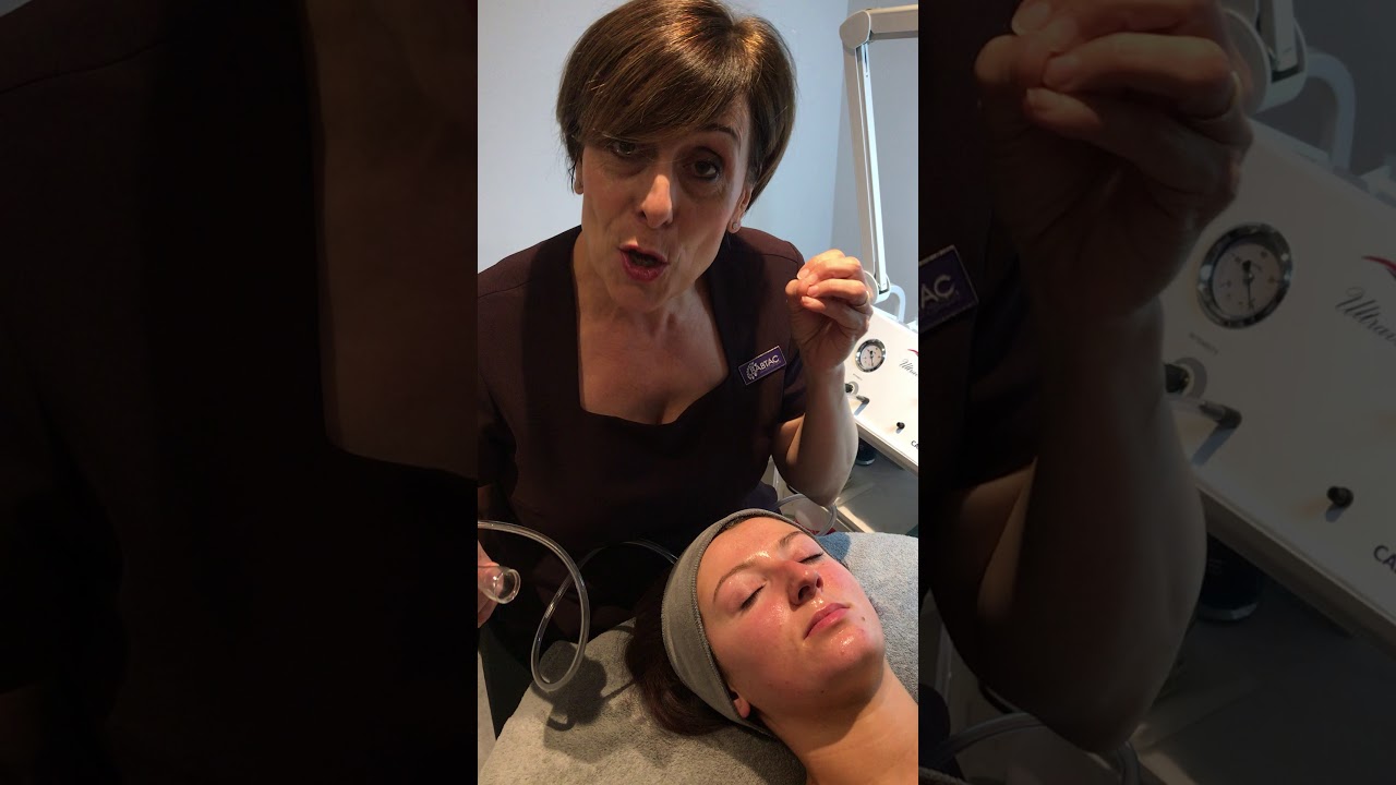 Vacuum Suction Facial