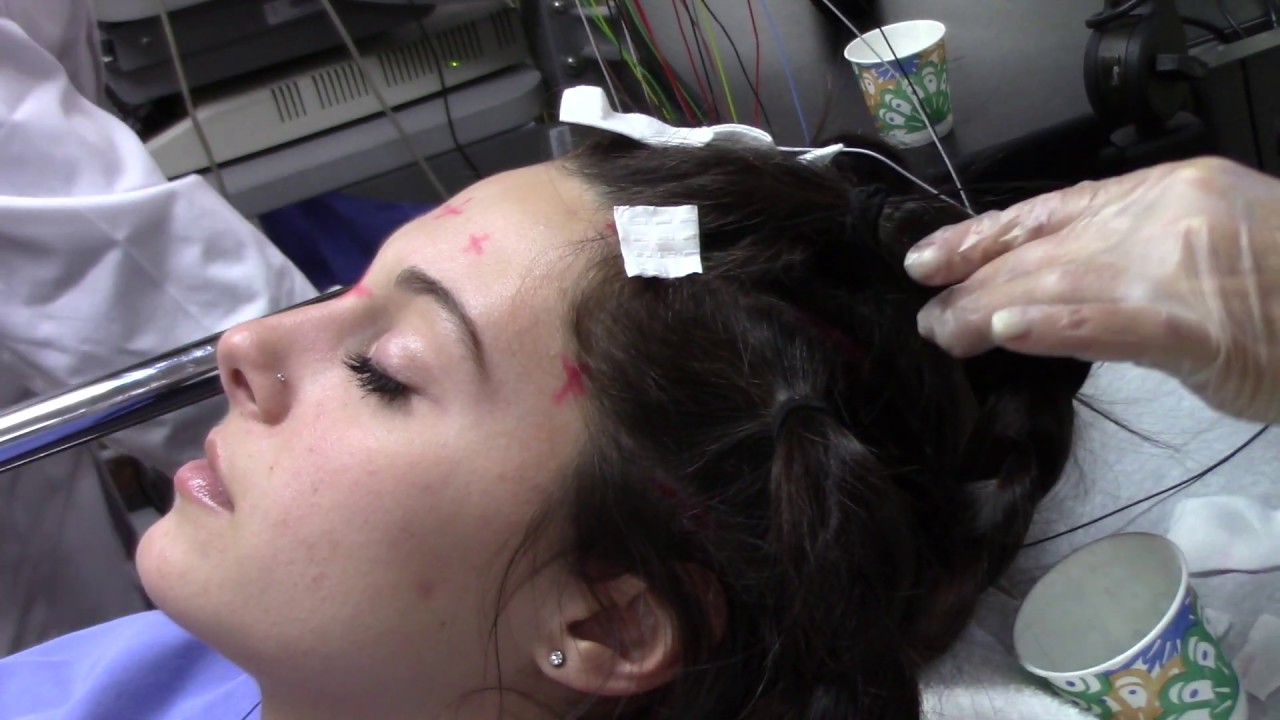 EEG Electrode Placement | AIMS Education