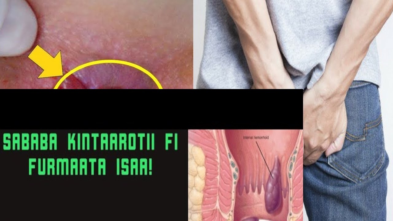 KINTAAROTII ILAALCHISEE KAN BEEKUU QABNU