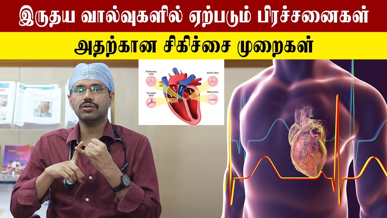 Valve Heart Disease Treatment Part-2 | இருதய வால்வு சார்ந்த சிகிச்சை முறைகள் என்ன? | Samayam Tamil