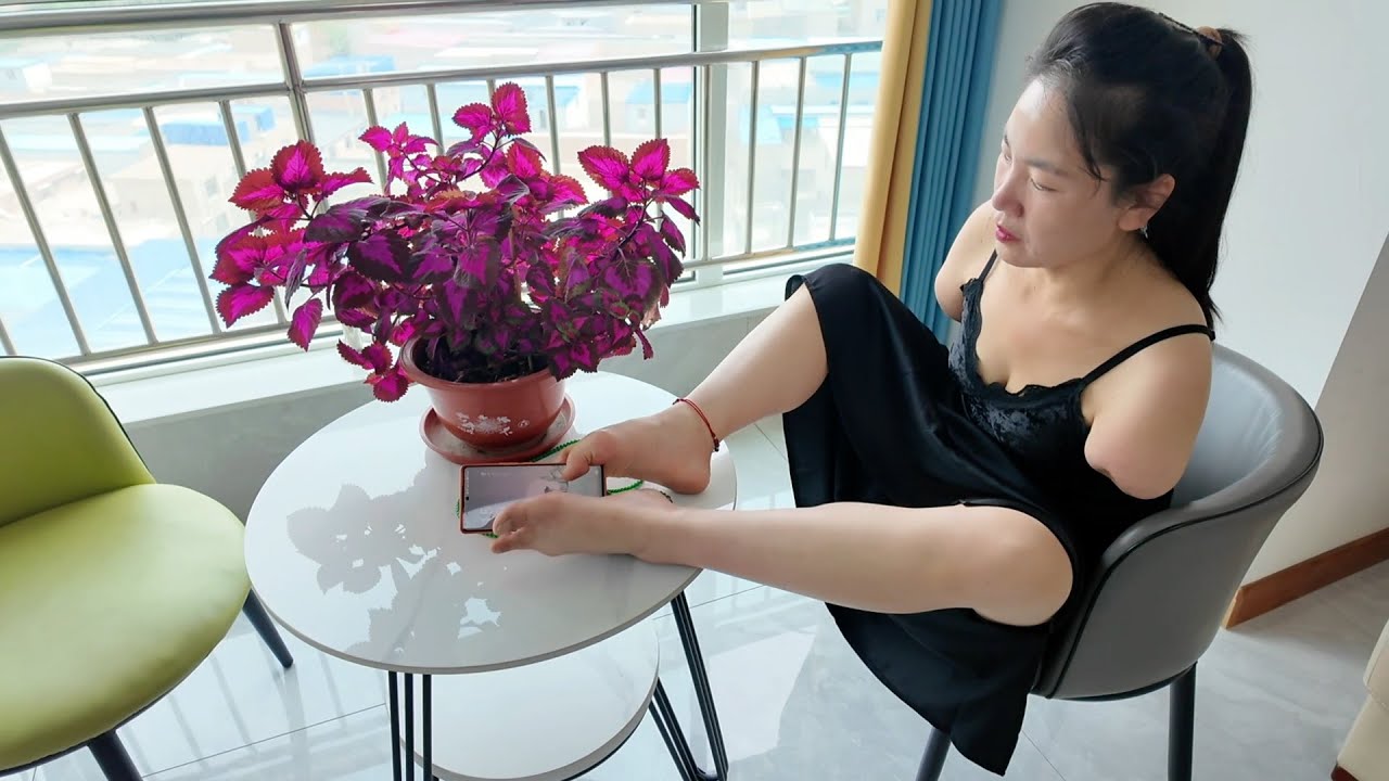 Annie: Dae Amputee girl  at hotel