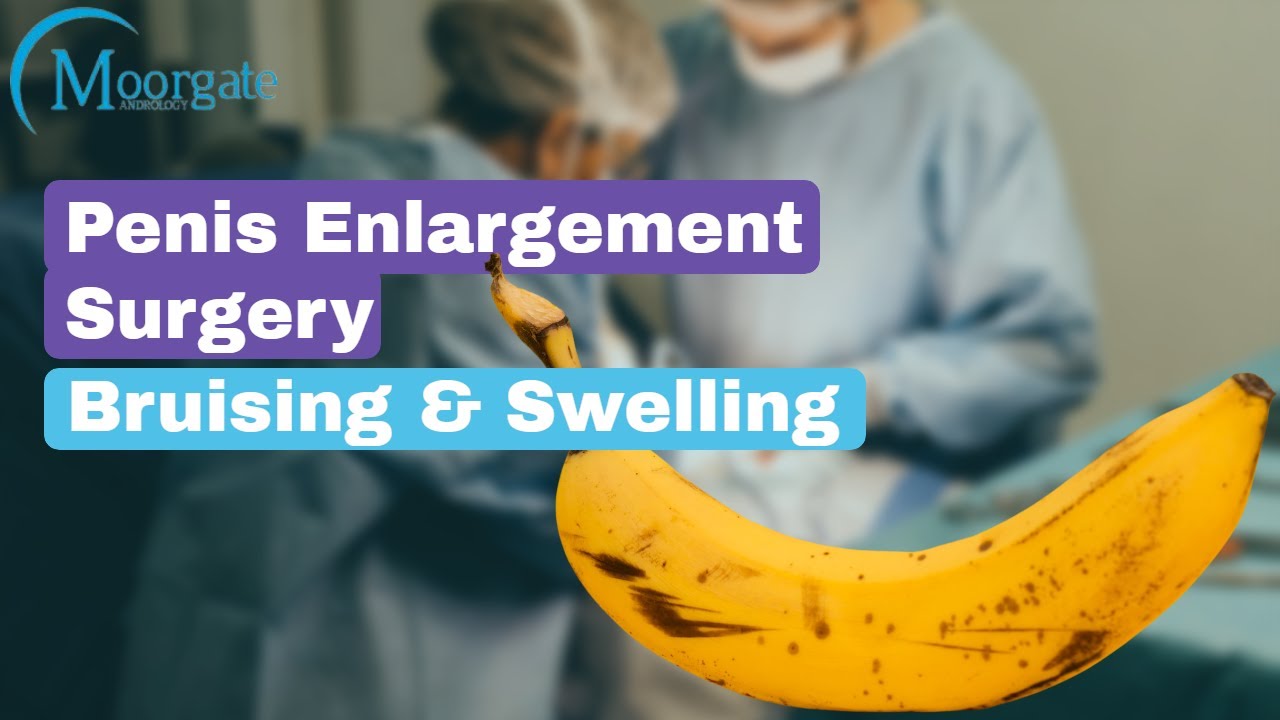 Penis Enlargement Surgery | Bruising and Swelling