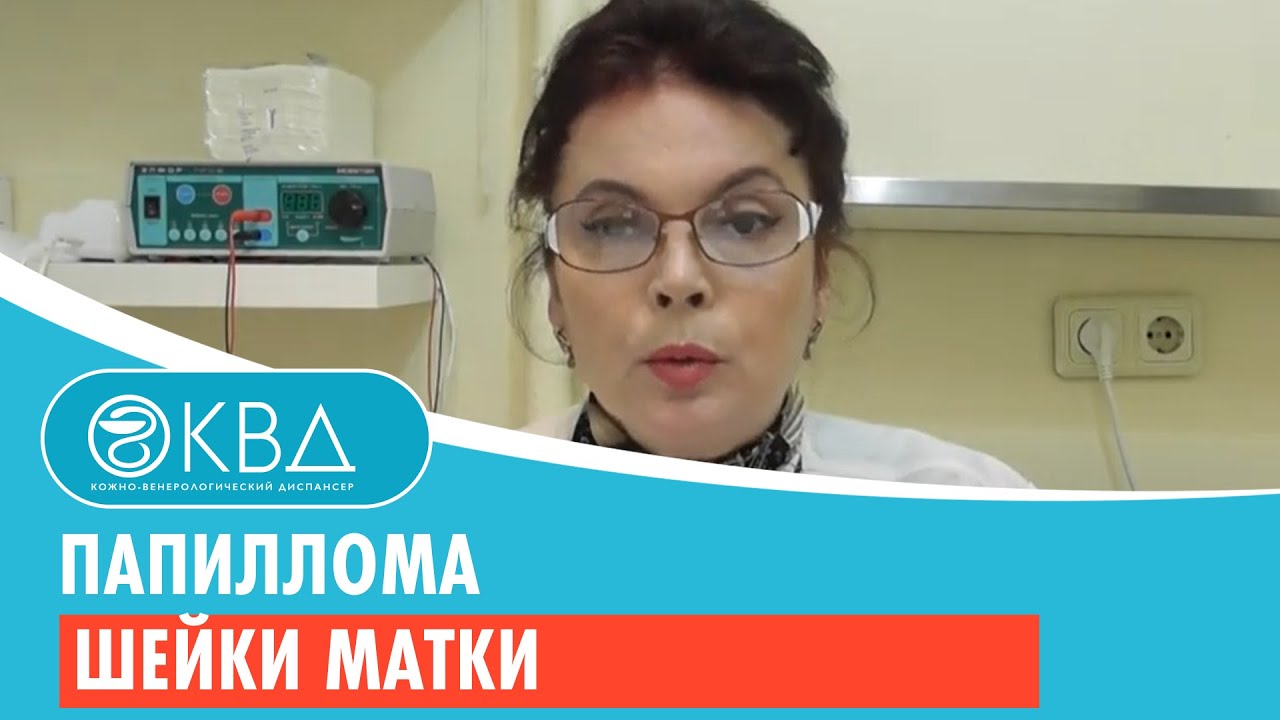 👩 1485  Папиллома шейки матки