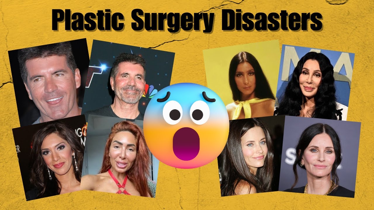 Top 10 WORST Celebrity Plastic Surgery Disasters: Surgeons React!