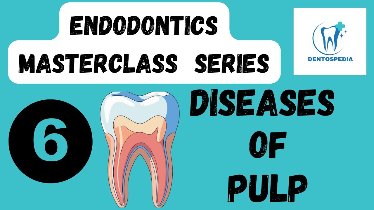 Endo 6 Diseases of the Pulp Explained | Endodontics Masterclass #afk #adat  #ore #lds #mfds #adc