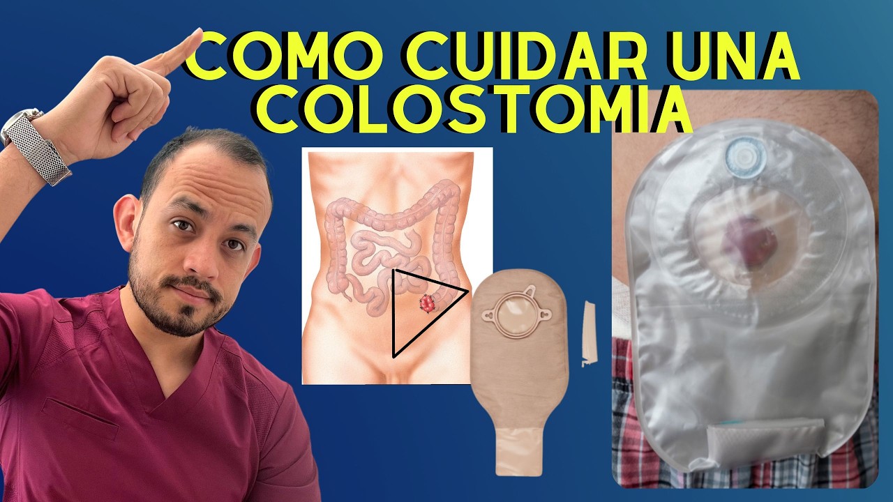 Como Cuidar una Colostomia o Ileostomia? Problemas resueltos | Enf. Erika Andrade | Podcast