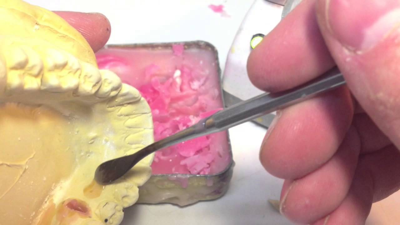 Removing Expansion Screw Tab
