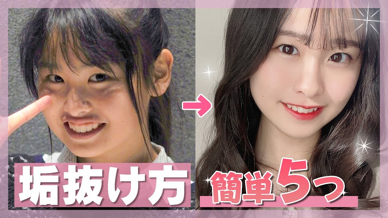 【垢抜け】可愛くなるためにもかがやったこと5個を大公開！