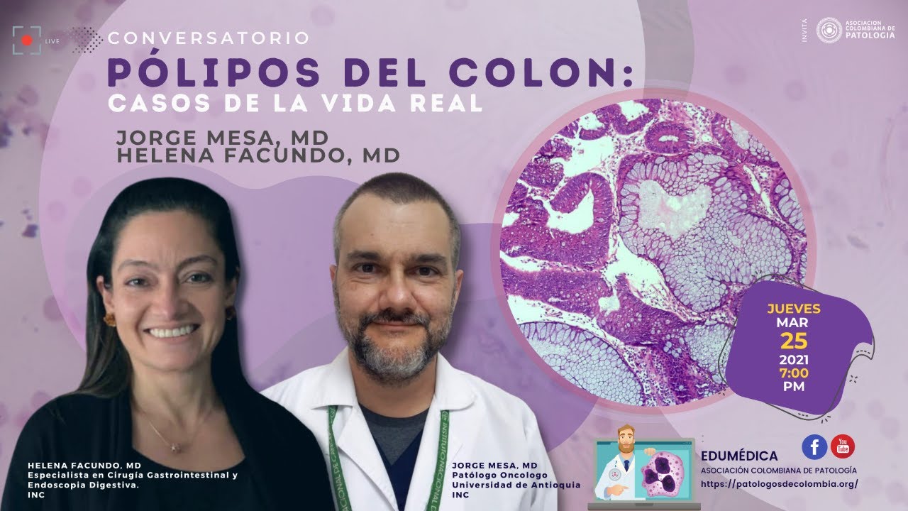 #PatologosdeColombia P&oacute;lipos del colon: casos de la vida real