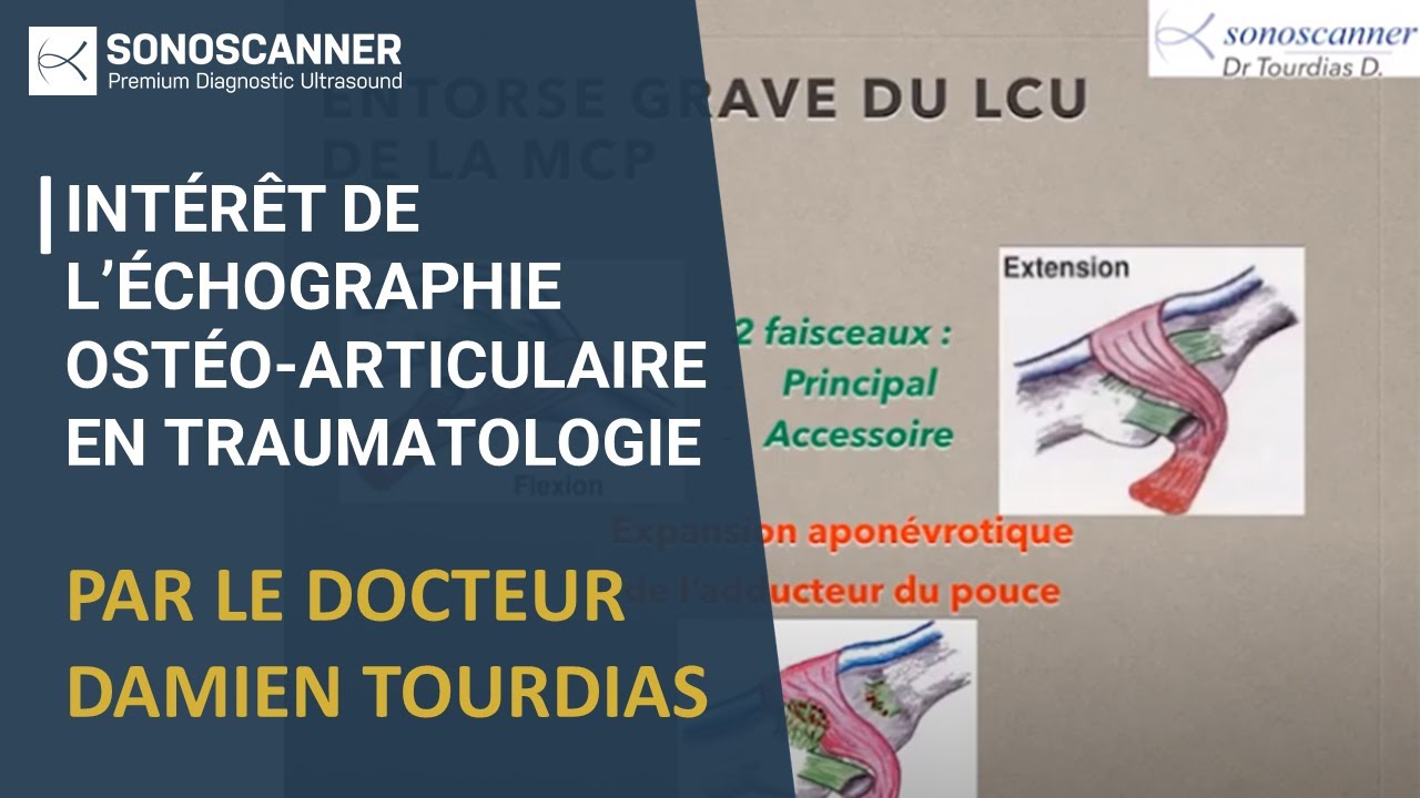 Webinar Sonoscanner : Intérêt de l’échographie ostéo-articulaire en traumatologie