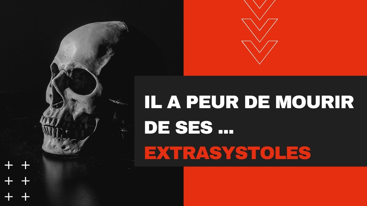 Mon patient a peur de mourir de ses EXTRASYSTOLES ventriculaires !!