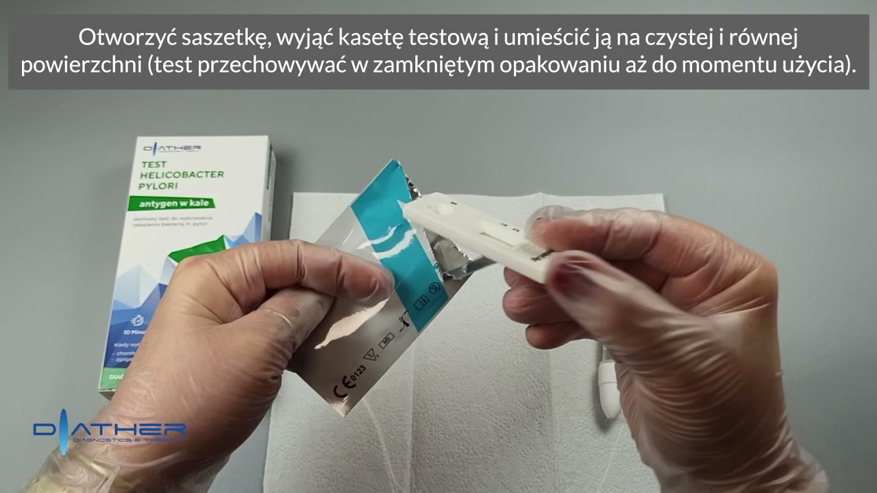 Test Helicobacter Pylori - wykonanie badania
