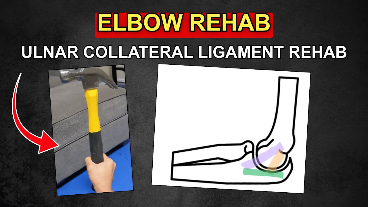 Elbow Series - 3 Rehab Exercises for Mild UCL Sprain