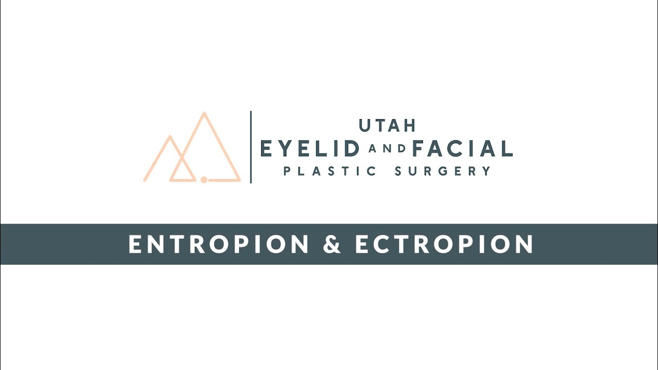 Ectropion, Entropion & Eyelid Retraction