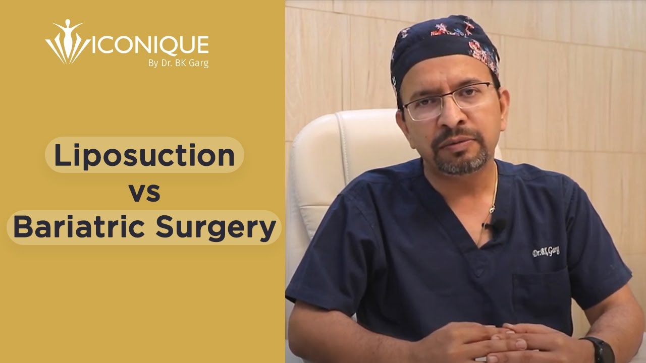 Liposuction Vs Bariatric Surgery | How Liposuction & Bariatric Surgery Differ? | Dr. BK Garg