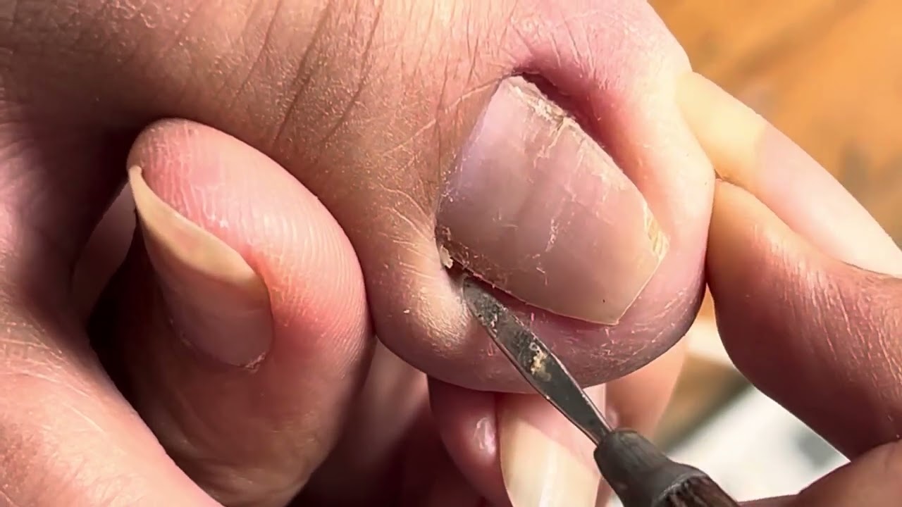Clean toenails