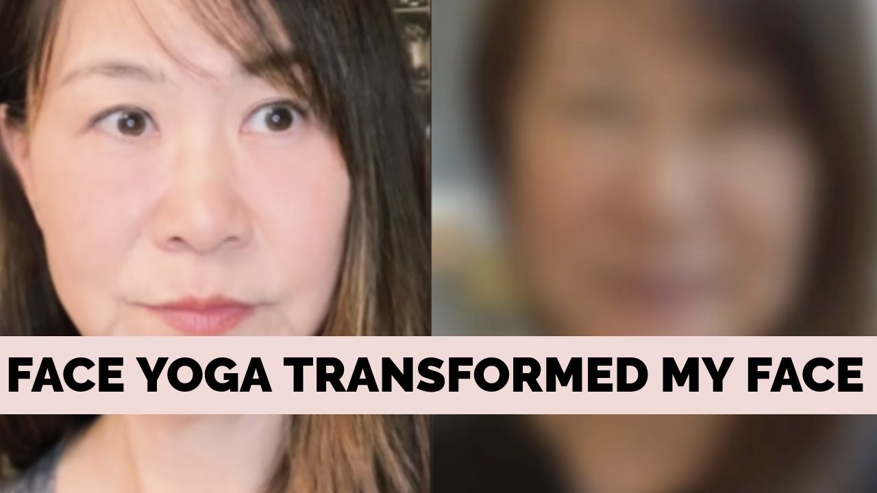 FACE LIFTING EXERCISES transformed my face! 10 min a day and look 10 years younger!