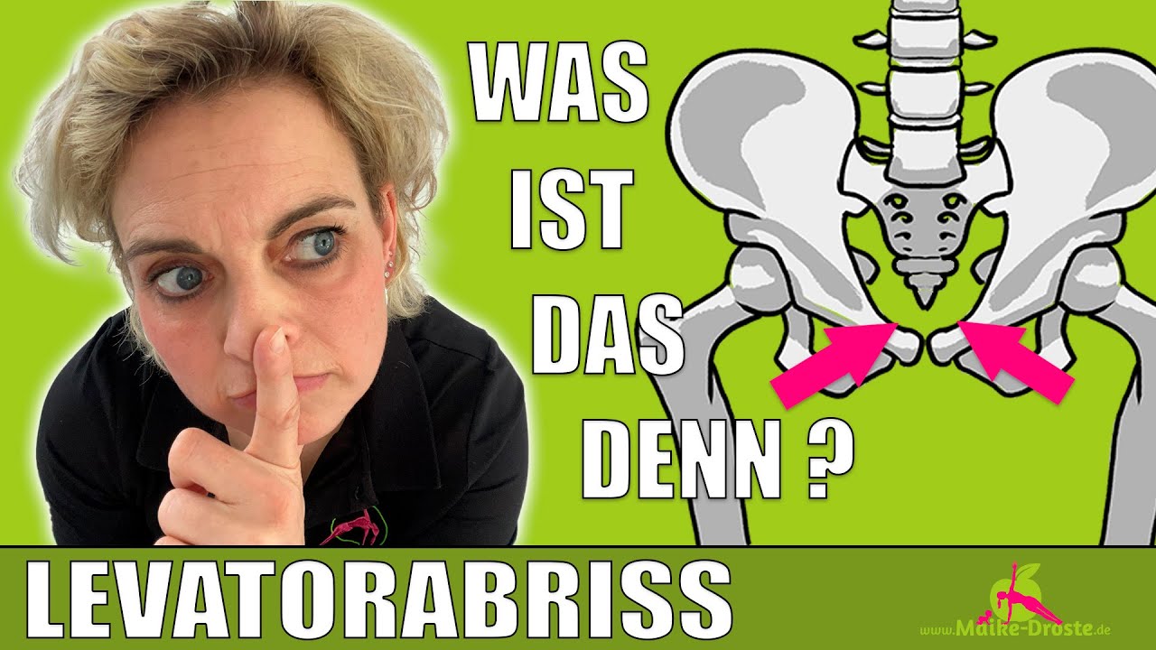 Levatorabriss verstehen - Was du WISSEN musst? Levator ani syndrom? Was ist ein Levatorabriß?