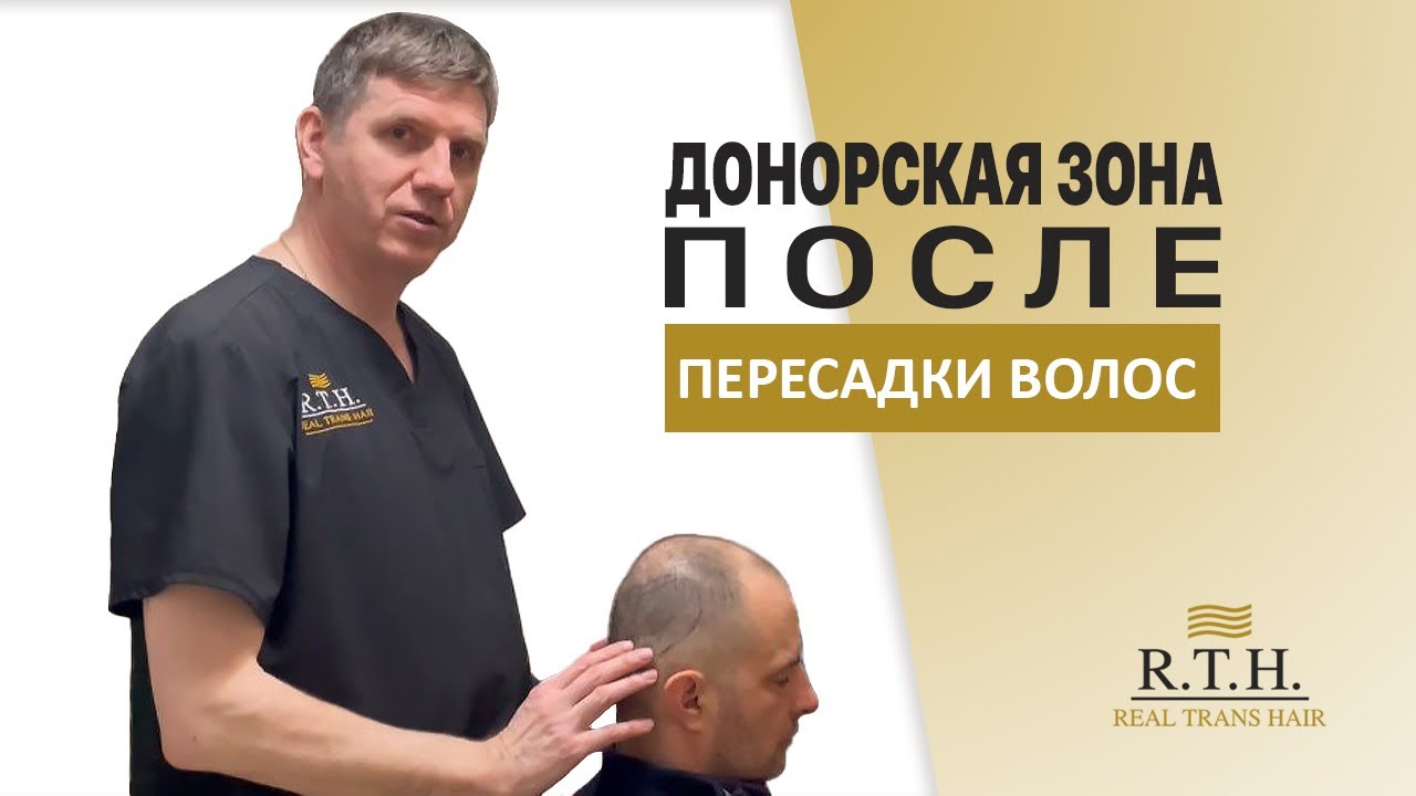 Донорская зона после пересадки волос. Будут ли видны следы? Хирург Иван Двинских