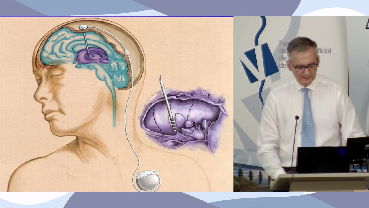 Conferencia Dr. Lozano: neuro-HIFU para el Parkinson y, a futuro, el Alzheimer y la depresión