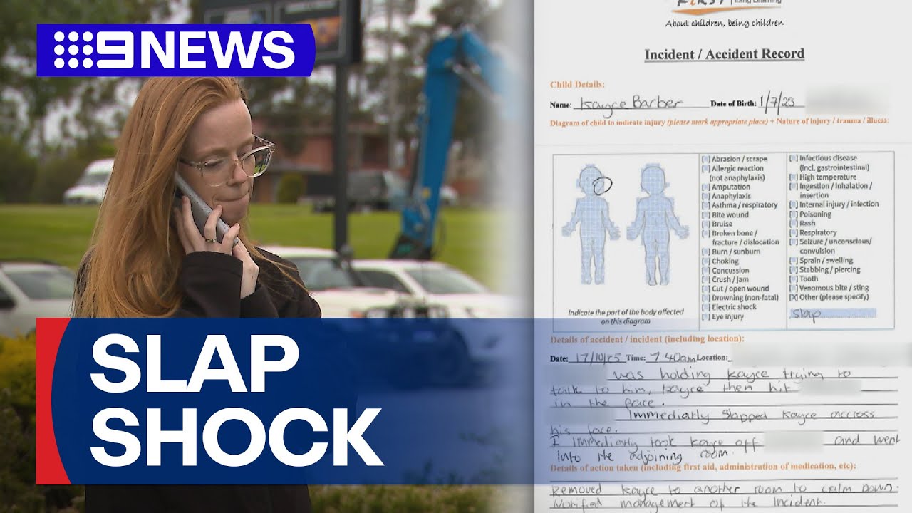 Toddler left traumatised after being slapped by a childcare worker | 9 News Australia