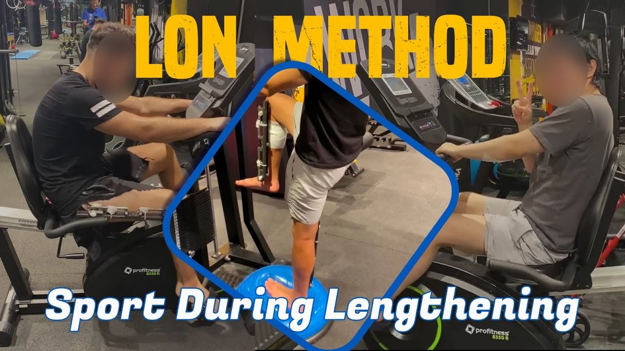 Can I do Sport/ fitness during the limb lengthening progress with the LON Method?