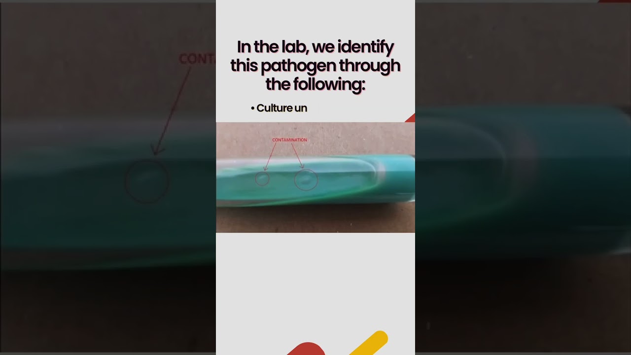 Mycobacterium tuberculosis #Bacteriology #Laboratory #MedicalTechnologist #Microbioworld