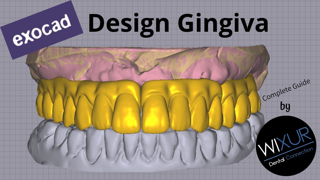 How To Design Gingiva - Exocad Full-Arch Case