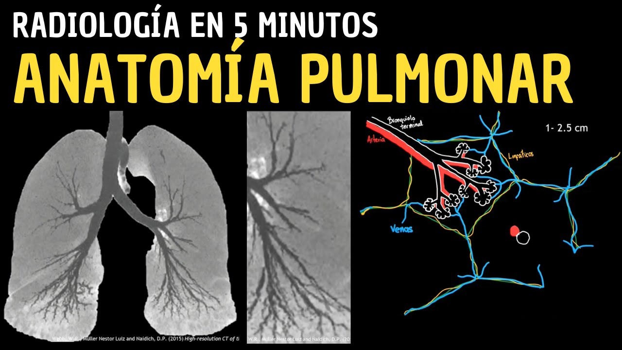 Radiología en 5 minutos: Anatomía pulmonar y densidades.
