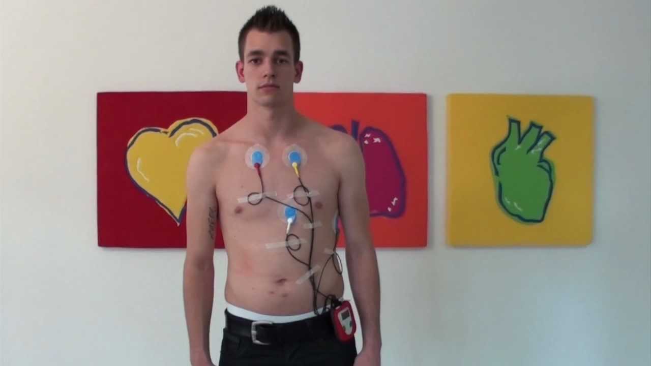 SCHILLER electrode placement for Holter MT-101 (and MT-101 nano) with 2-channel recording