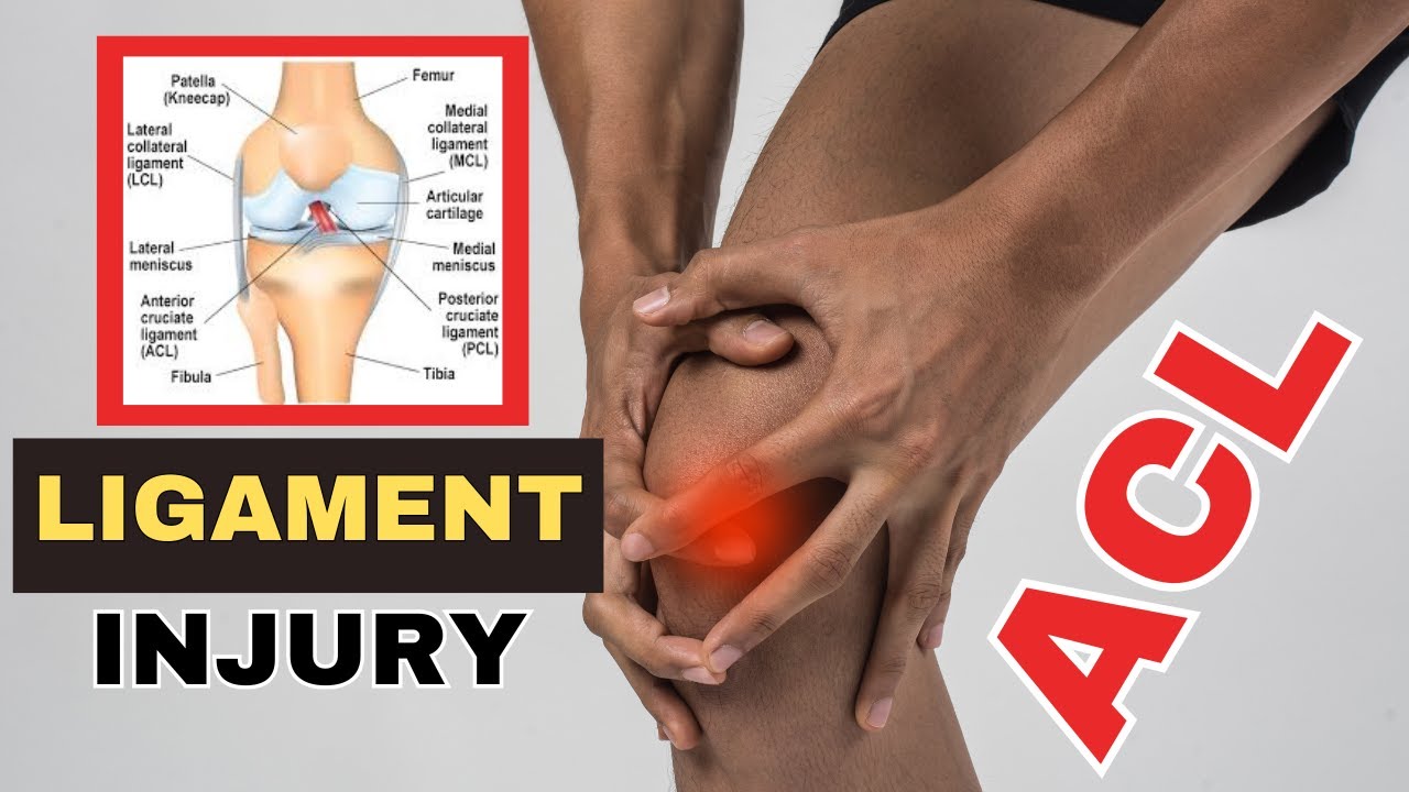 Grade 1 aur Grade 2  ACL Ligament injury me kya Exercises kare | Easy Recovery Tips by Doctor |