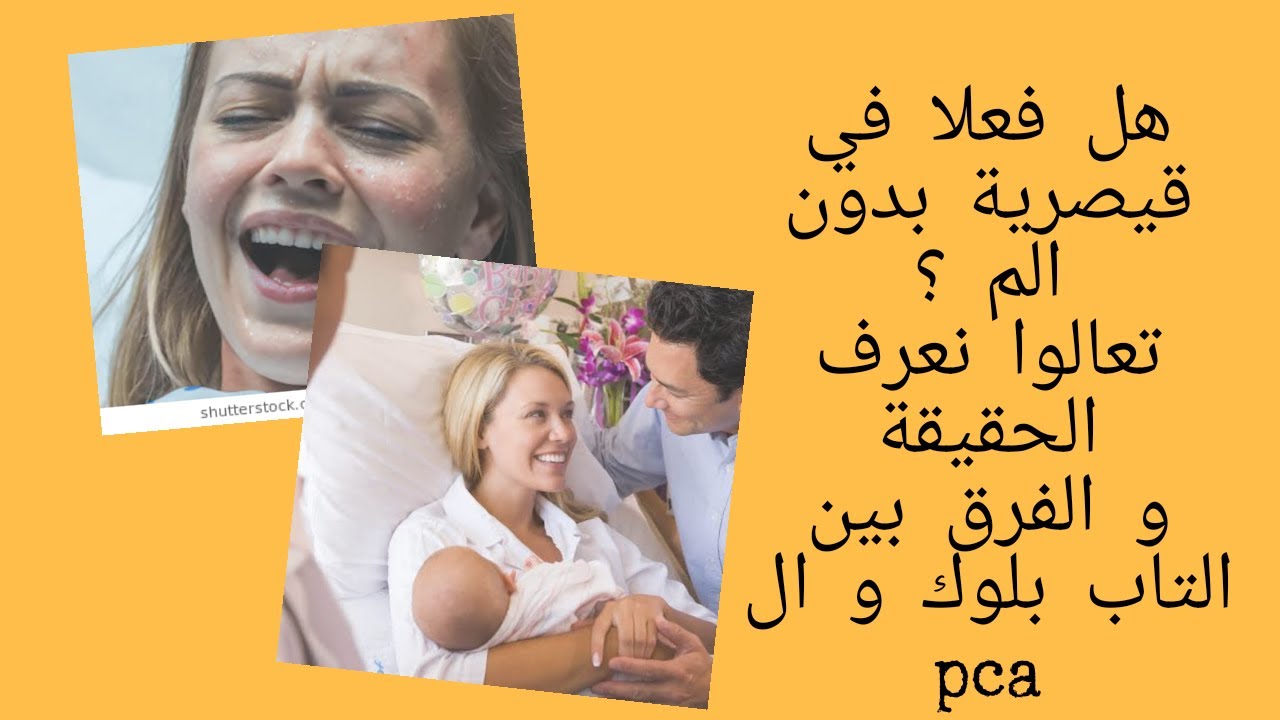 حقيقة الولادة القيصرية بدون الم و الفرق بين حقنة التاب بلوك وال pca
