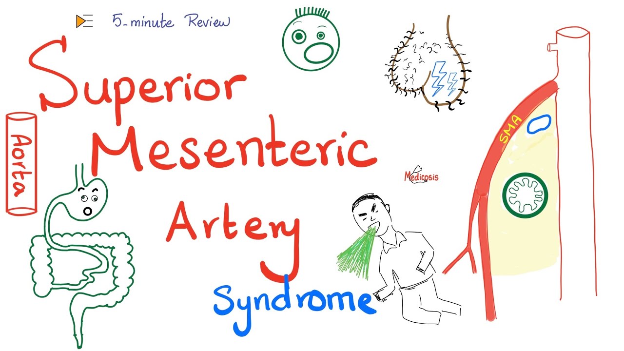 Superior Mesenteric Artery (SMA) Syndrome | Nutcracker Syndrome | Clinically-Oriented Anatomy
