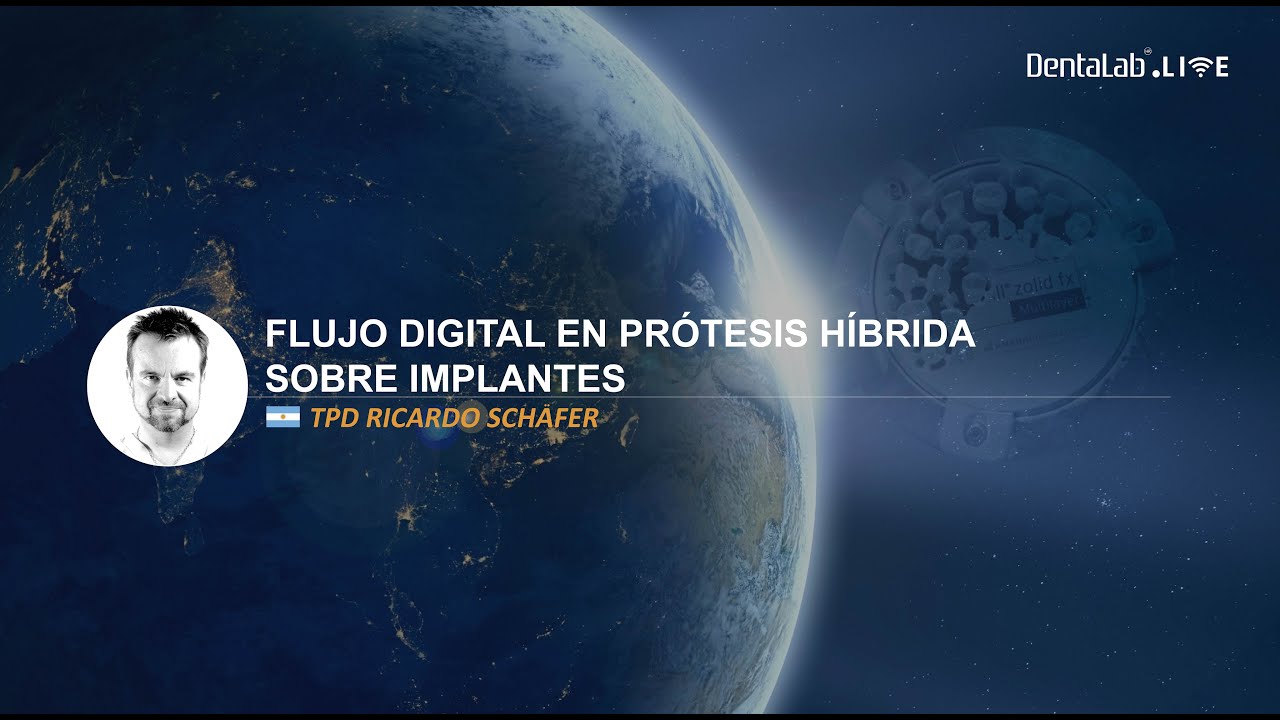 Flujo digital en prótesis híbridas sobre implantes - Ricardo Schafer