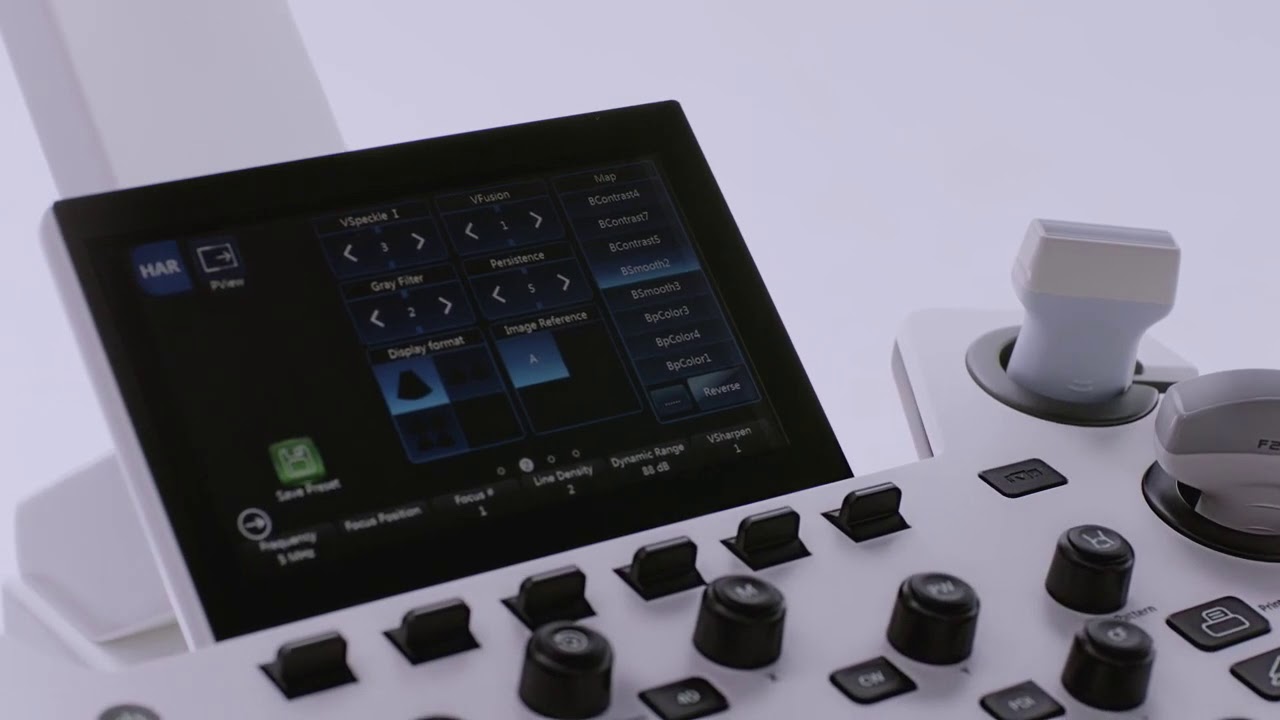 VINNO X1 | ULTRASOUND