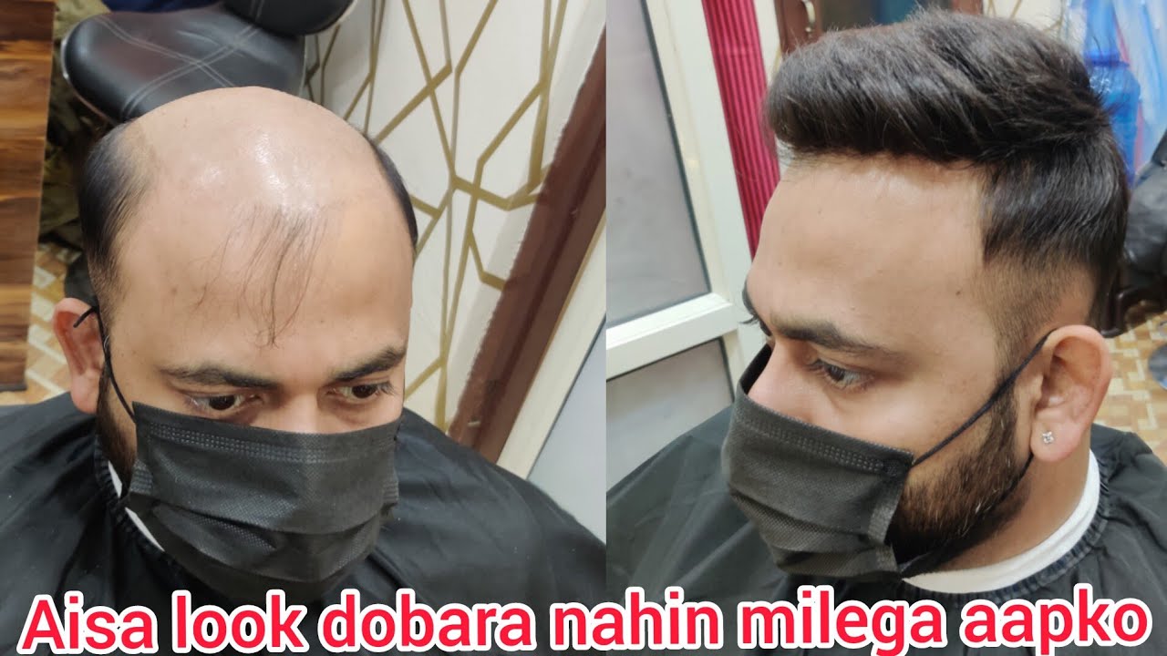 hair replacement in Delhi full lace hair patch ki service kis tarah ki jaati hai #viralvideo